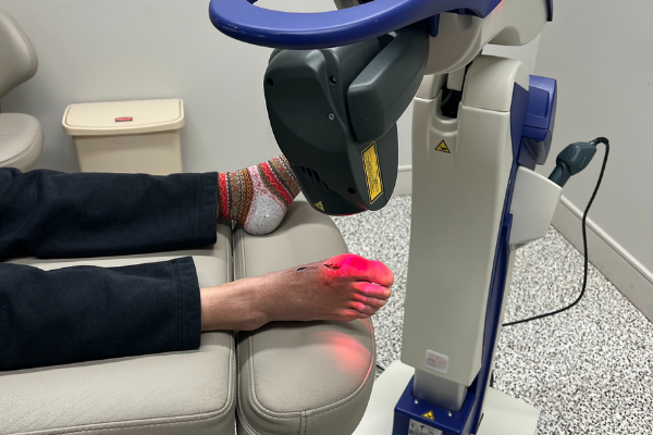 Robotic M6 MLs Therapy Laser Treating a Patient's Foot Post-operatively