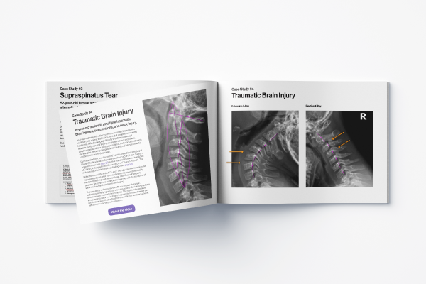 eBook Preview: Maximize Patient Outcomes and Practice Profitability with Robotic Laser Technology