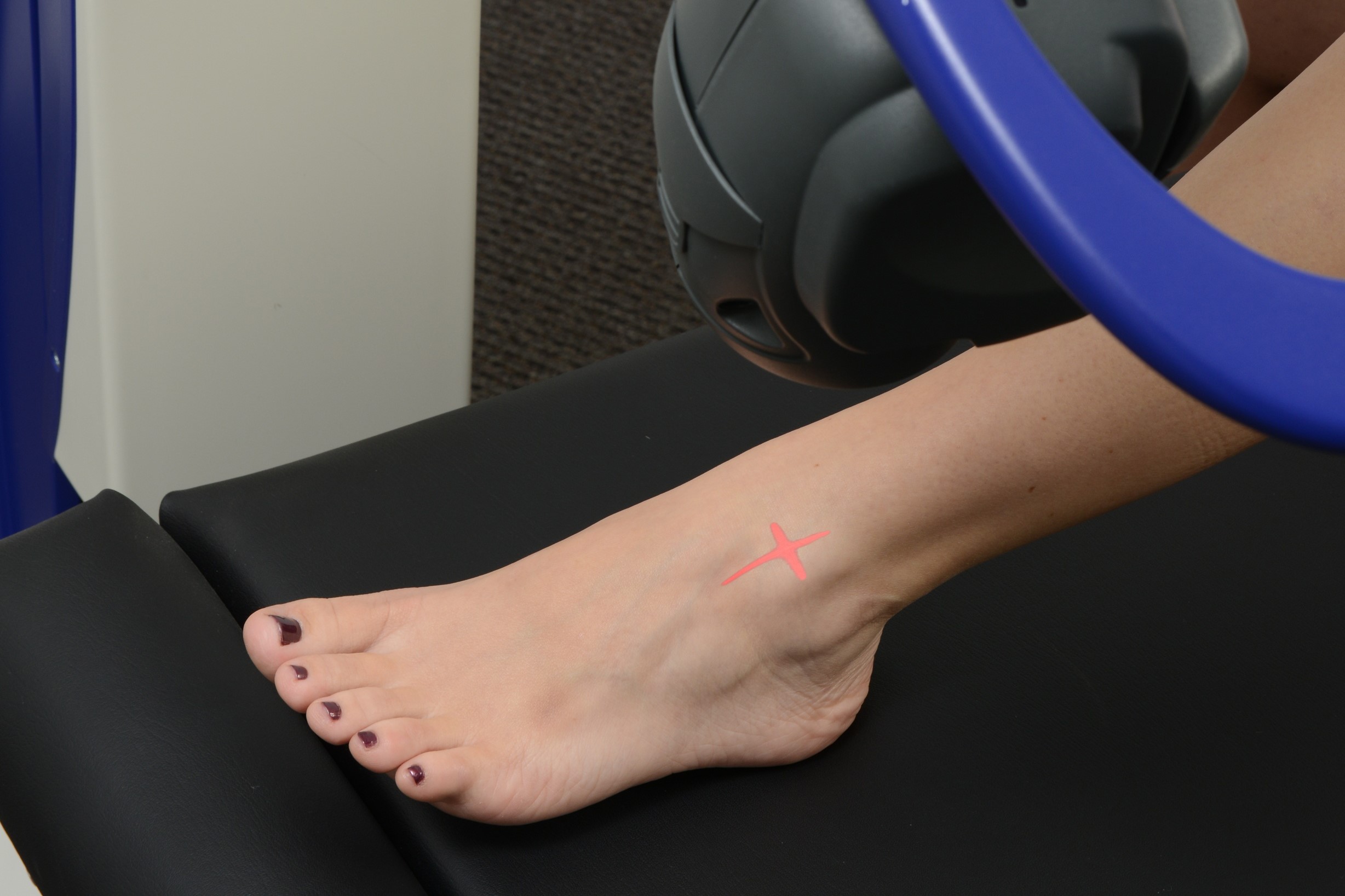 A woman's foot being treated with the M6 MLS Therapy Laser