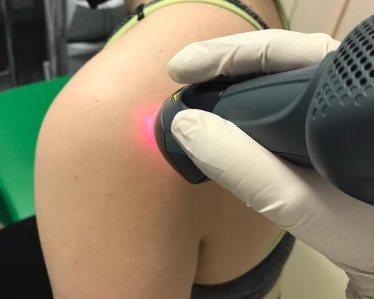 A patient's shoulder being treated with MLS Laser Therapy.